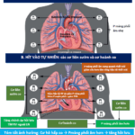 Thông khí áp lực dương trong hồi sức tim mạch CICU