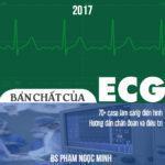 Bản chất ECG