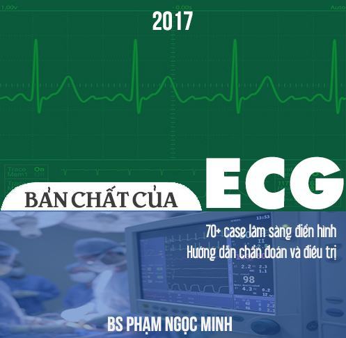 Bản chất ECG