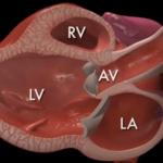 Các mặt cắt trong siêu âm tim