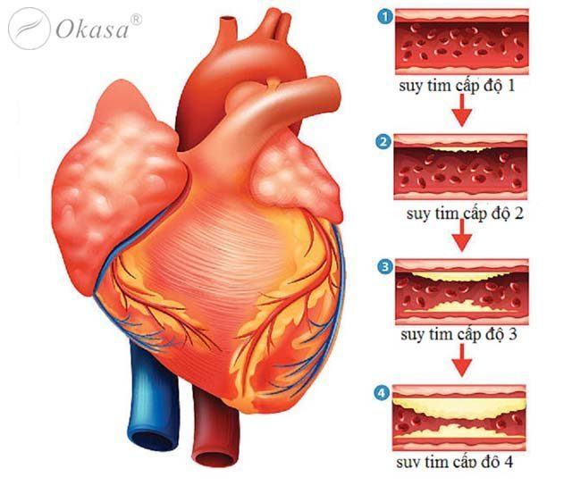 Hướng dẫn chẩn đoán và điều trị suy tim cấp và mạn Hướng dẫn chẩn đoán và điều trị suy tim cấp và mạn