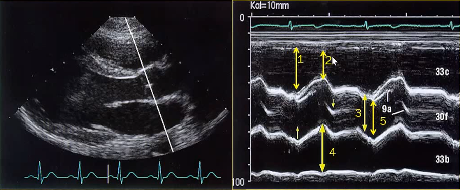 7. Các Biện Pháp Hỗ Trợ Giảm PAPs