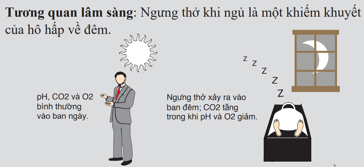 Hội chứng ngưng thở khi ngủ do nguyên nhân trung ương Hội chứng ngưng thở khi ngủ do nguyên nhân trung ương