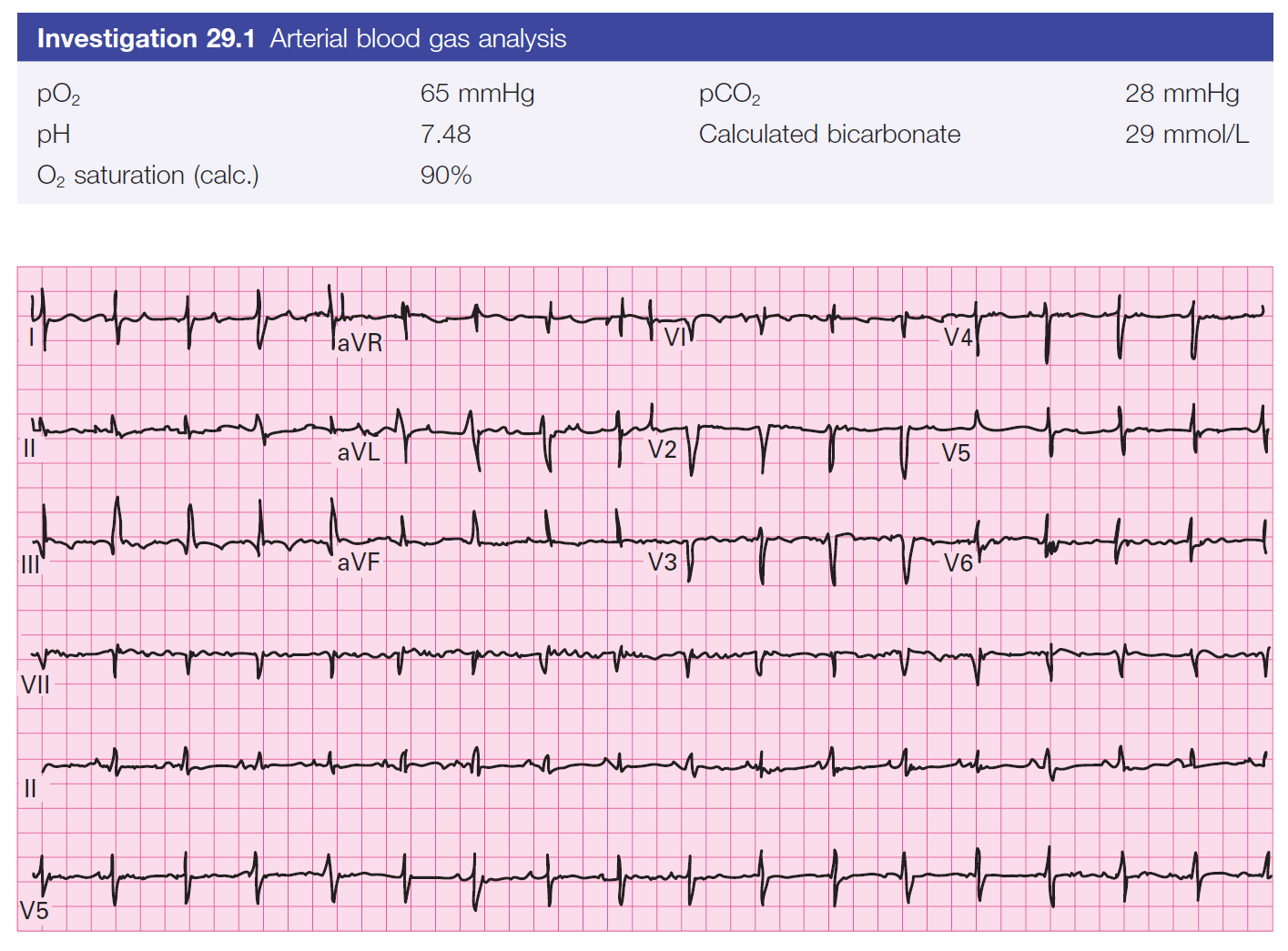 Figure 29.1 Electrocardiograph