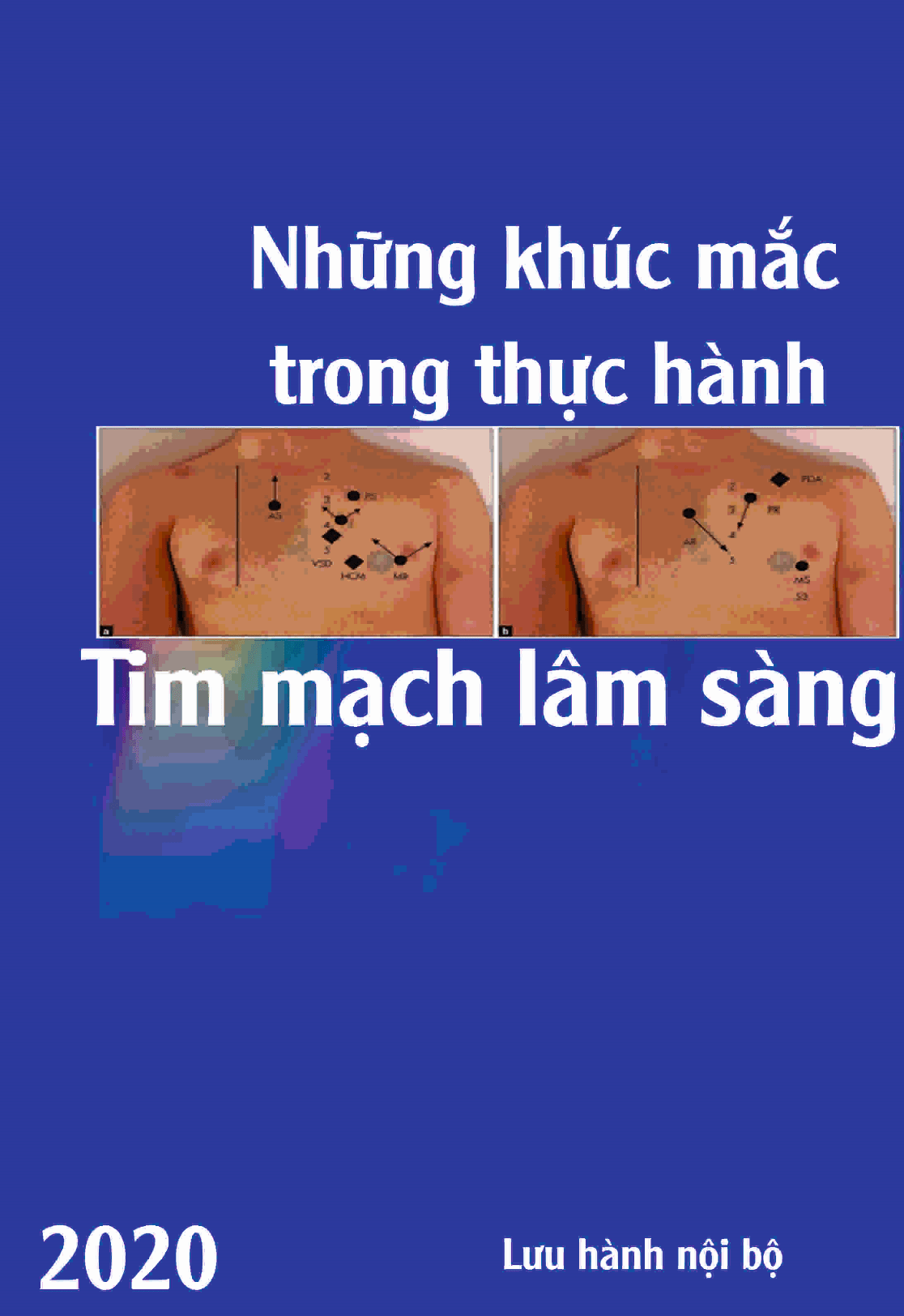 Sách nói những khúc mắc trong thực hành tim mạch lâm sàng Sách nói những khúc mắc trong thực hành tim mạch lâm sàng