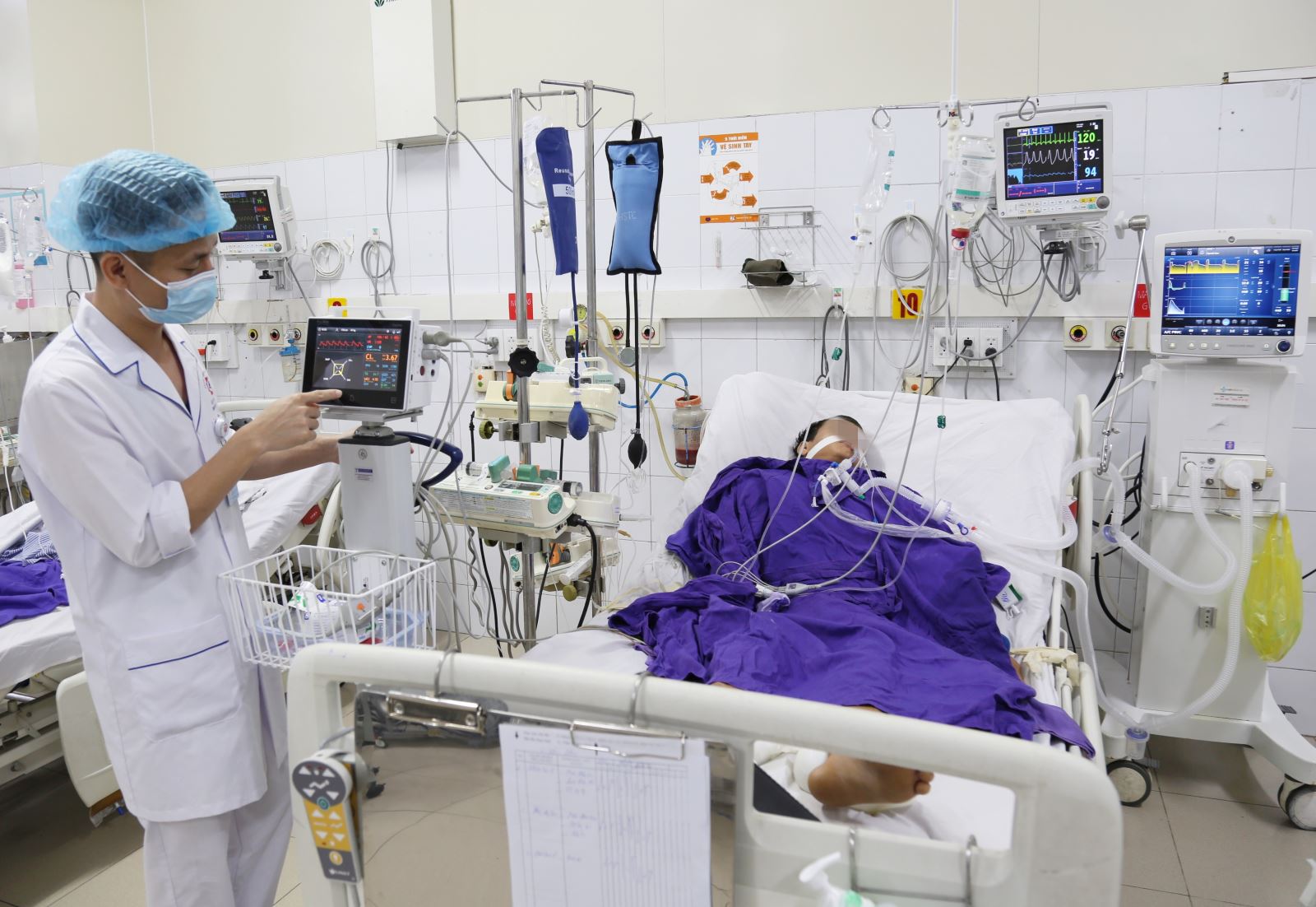 Bệnh nhân được theo dõi huyết động xâm nhập trong ICU thể hiện sự phức tạp và tầm quan trọng của việc theo dõi liên tục các chỉ số sinh tồn