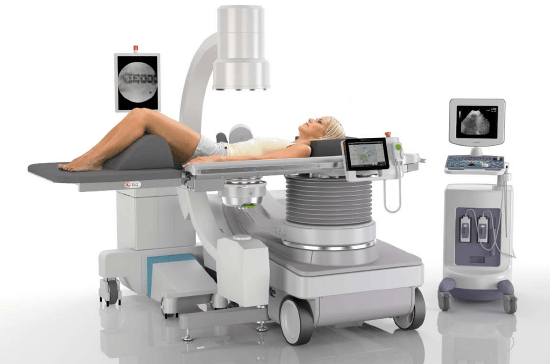 Nghiên cứu tán sỏi ngoài cơ thể