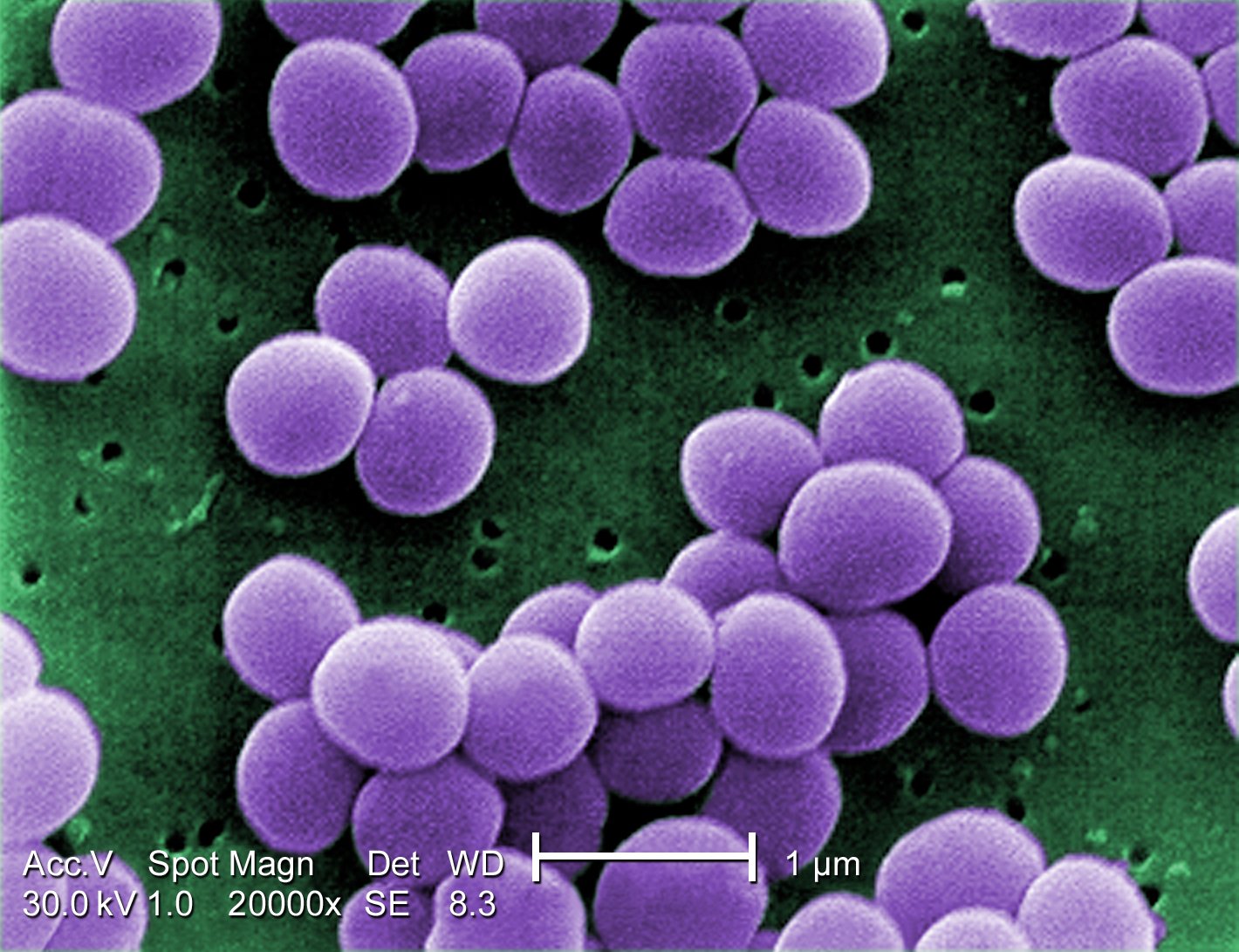 Vi khuẩn MRSA dưới kính hiển vi điện tử