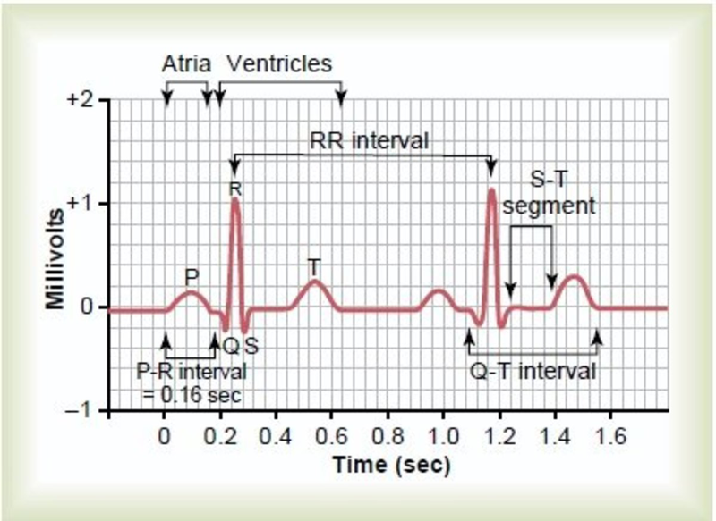 Hình ảnh điện tâm đồ ECG với các sóng P QRS T thể hiện hoạt động điện của tim