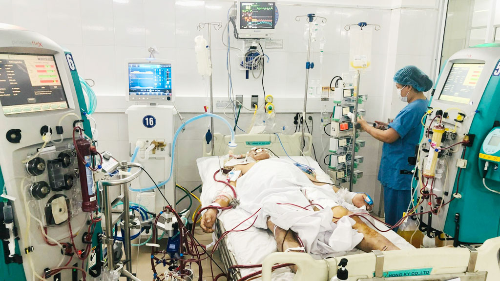 Một bệnh nhân đang được hỗ trợ ECMO với các ống dẫn máu nối với máy ECMO