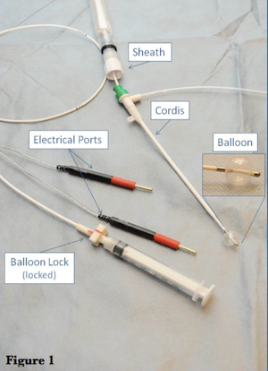Hình ảnh minh họa quá trình đưa catheter tạo nhịp qua tĩnh mạch vào tim