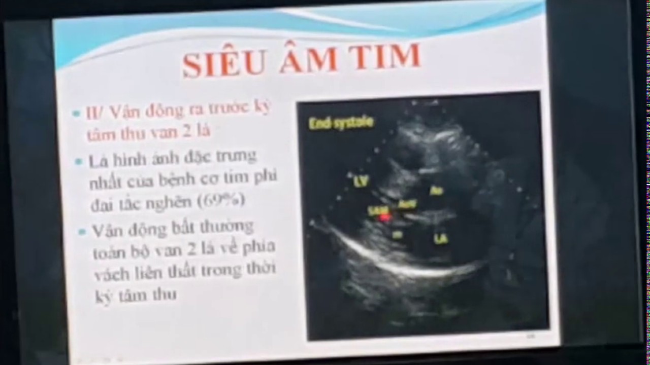 SIÊU ÂM ĐÁNH GIÁ CHỨC NĂNG TIM