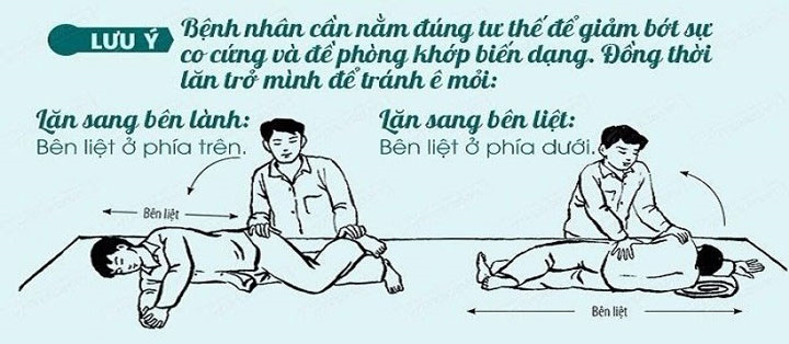 Điều dưỡng thay đổi tư thế cho bệnh nhân nằm liệt giường một biện pháp quan trọng để phòng ngừa loét tỳ đè