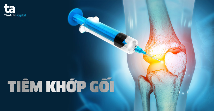 Ống tiêm chứa corticosteroid