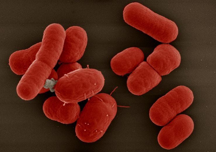 Hình ảnh hiển vi điện tử của vi khuẩn Klebsiella pneumoniae