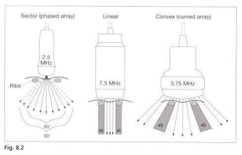 So sánh đầu dò siêu âm linear và curved