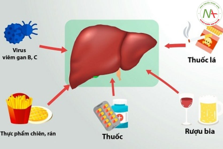 Các nguyên nhân phổ biến gây suy gan cấp