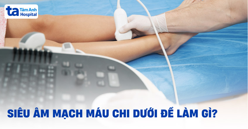 Hình ảnh Bmode cho thấy mảng xơ vữa trong động mạch chi dưới