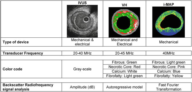 Hình ảnh IVUS cho thấy thành phần mảng xơ vữa bao gồm lõi lipid và vôi hóa