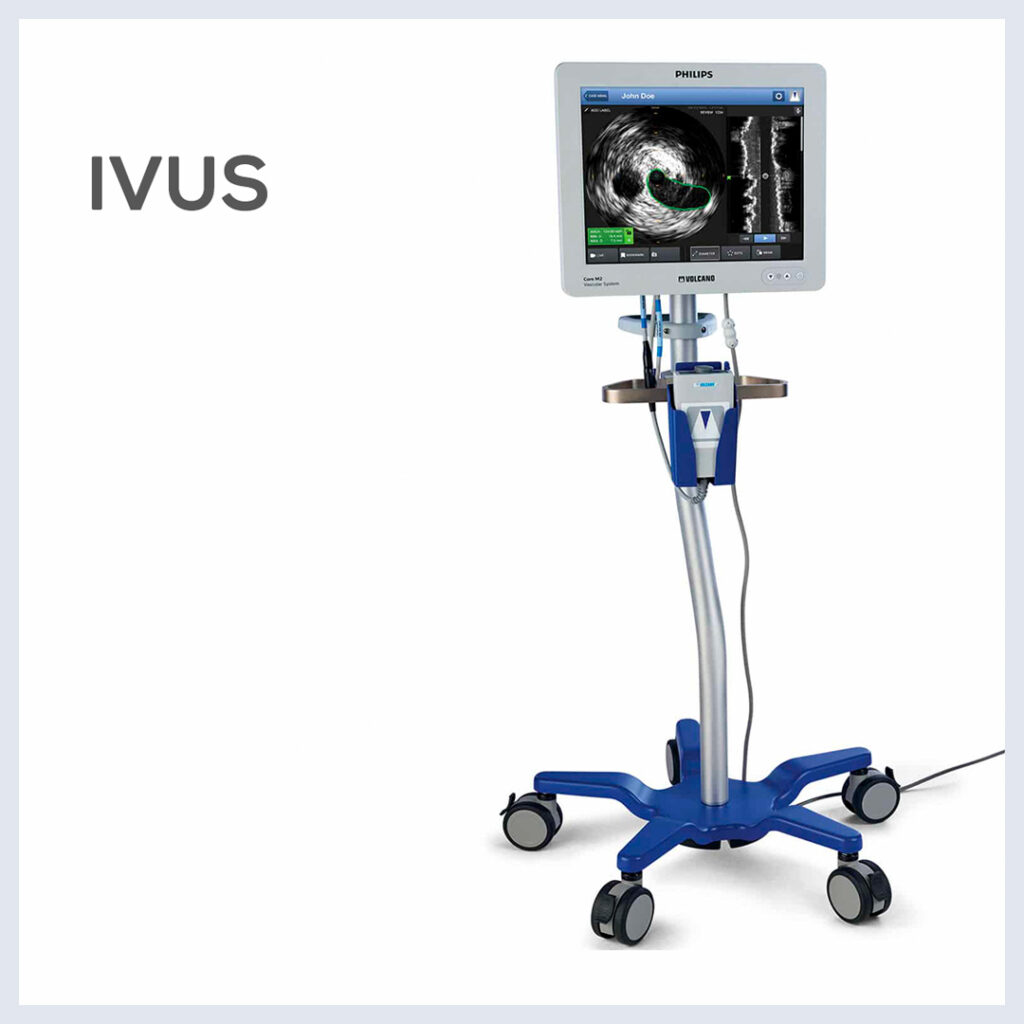 Máy IVUS thế hệ đầu tiên cồng kềnh và chất lượng hình ảnh còn hạn chế
