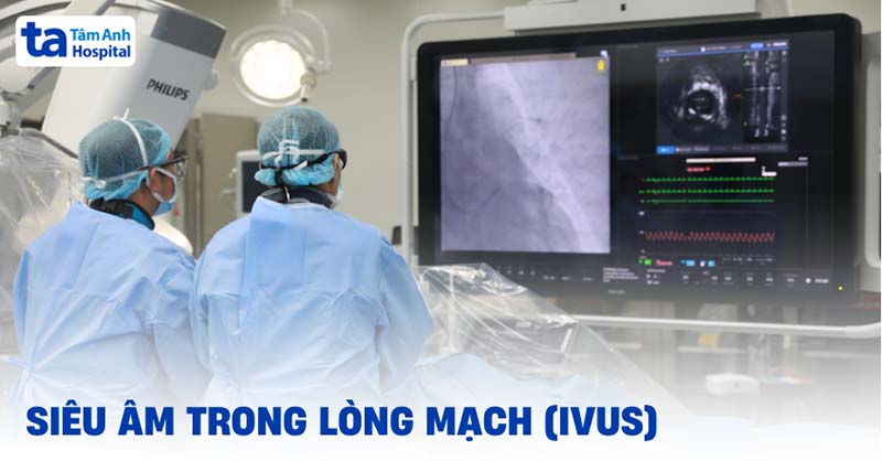 Hình ảnh IVUS cho thấy mảng xơ vữa trong lòng mạch vành